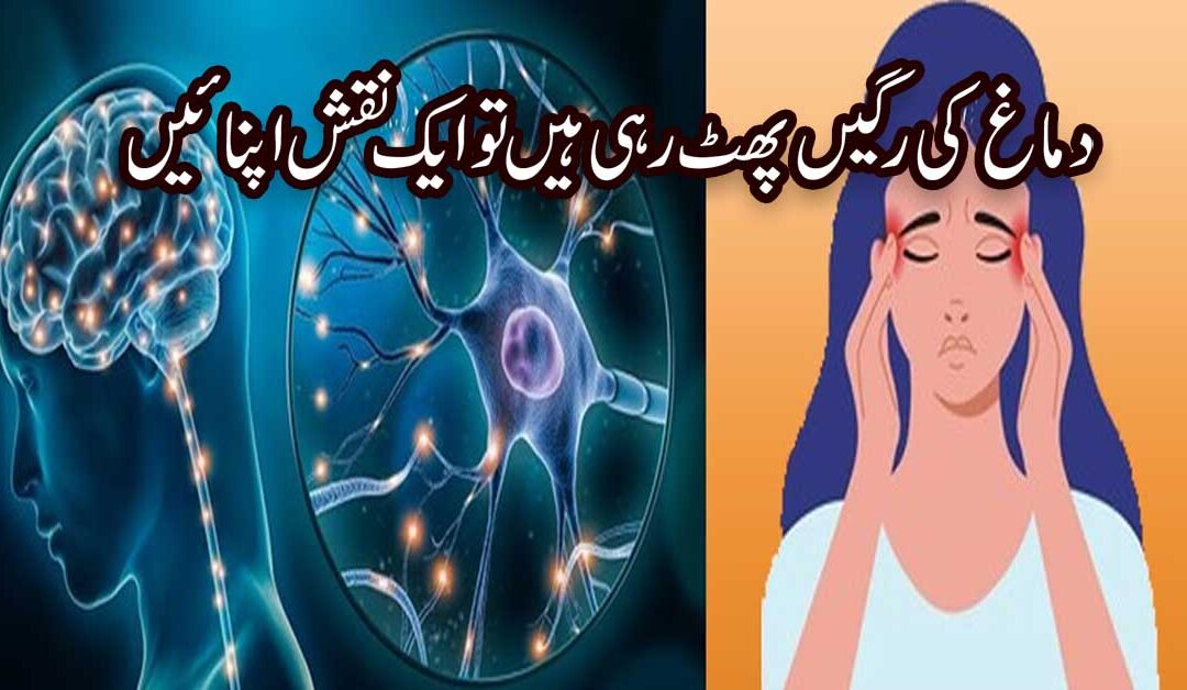 Dimag Ki Ragon Mein Dard Ka Pharphrana