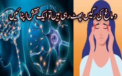 Dimag Ki Ragon Mein Dard Ka Pharphrana