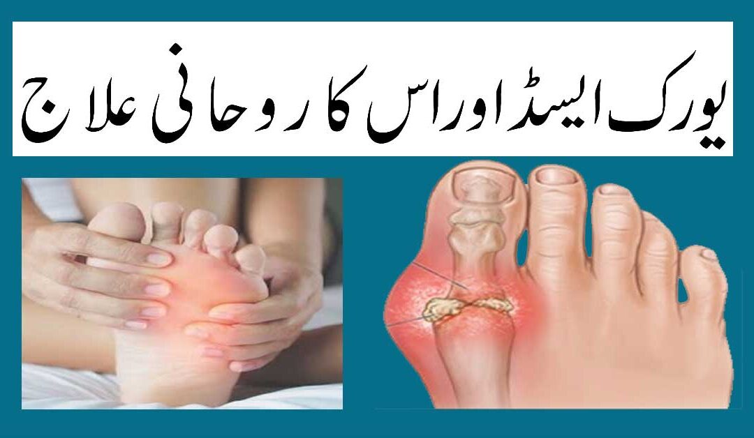 Uric Acid Na high Hoga Na Low