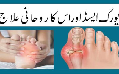 Uric Acid Na high Hoga Na Low