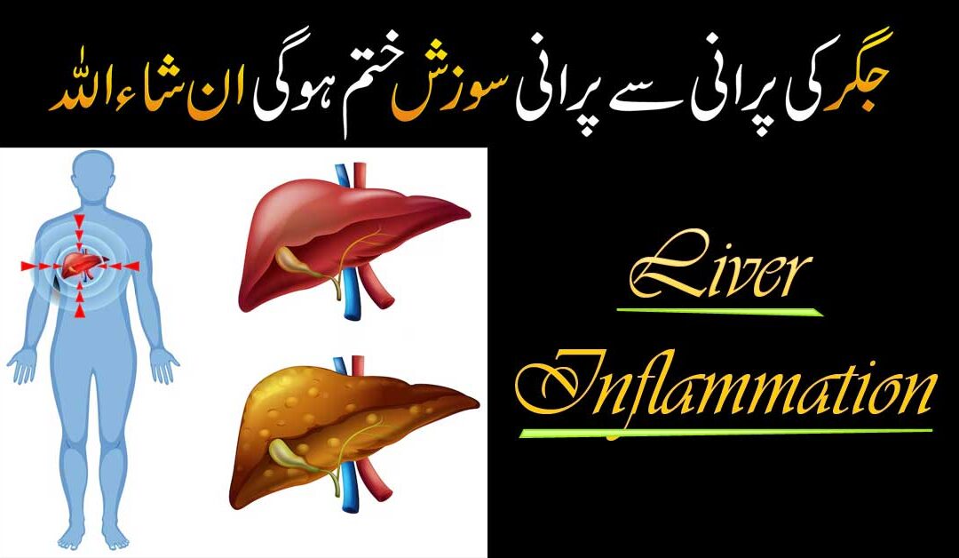 Jigar Ki Sozish Ko Khatam Karne Ka Taweez