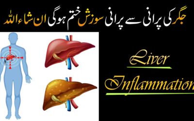 Jigar Ki Sozish Ko Khatam Karne Ka Taweez