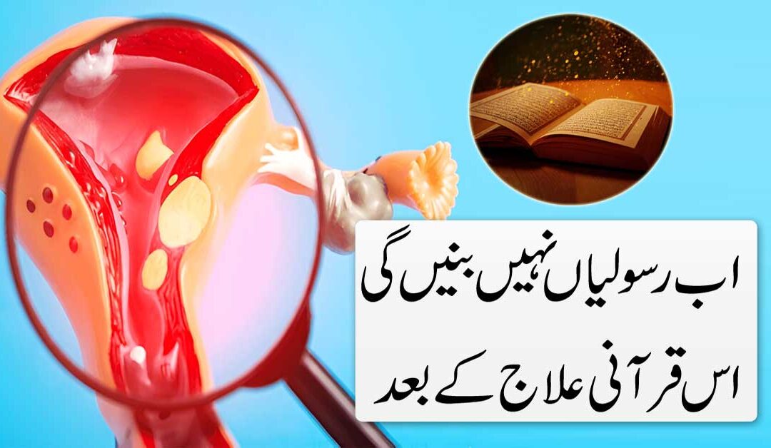 Fibroid Se Shifa Ka Quran Ilaj