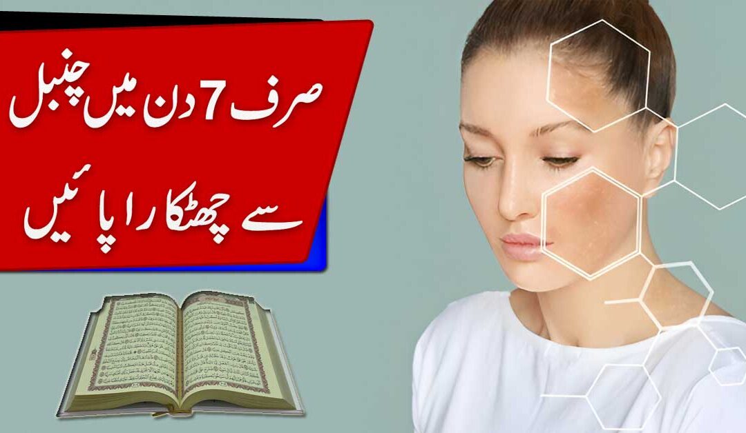 Chambal Ki Bimari Se Nijat Ka Naqsh
