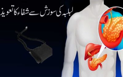 Lablaba Ki Sozish Se Shifa Ka Taweez