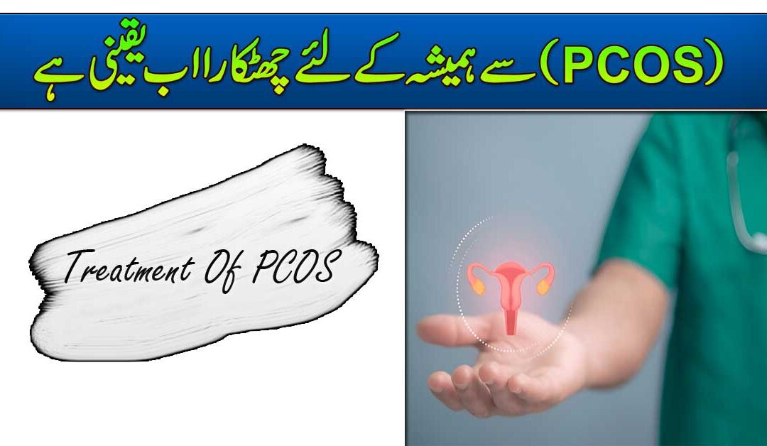PCOS Se Hamesha Ke Liye Chutkara