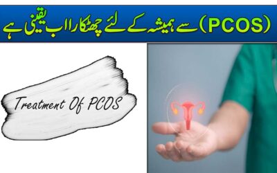 PCOS Se Hamesha Ke Liye Chutkara