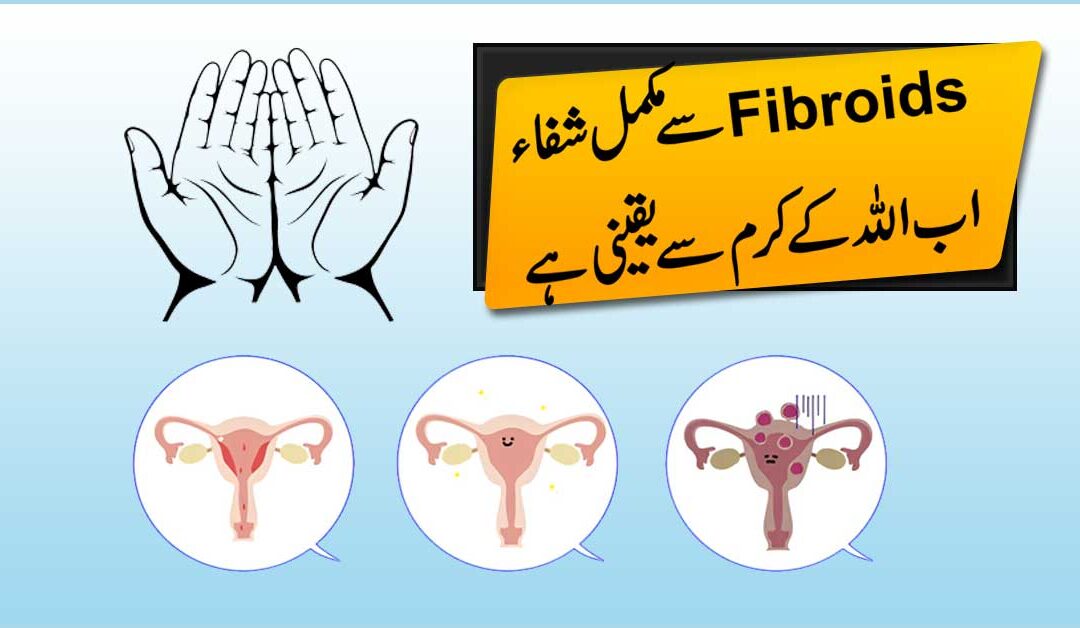 Fibroids Se Hamesha Ke Liye Nijat
