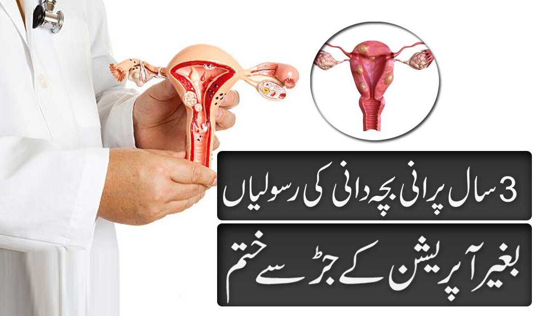 Bachedani Ki Rasoli Ka Ilaj