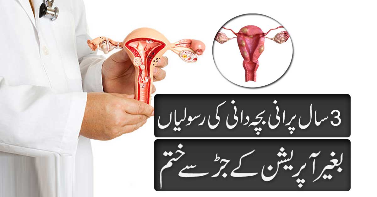 Bachedani Ki Rasoli Ka Ilaj